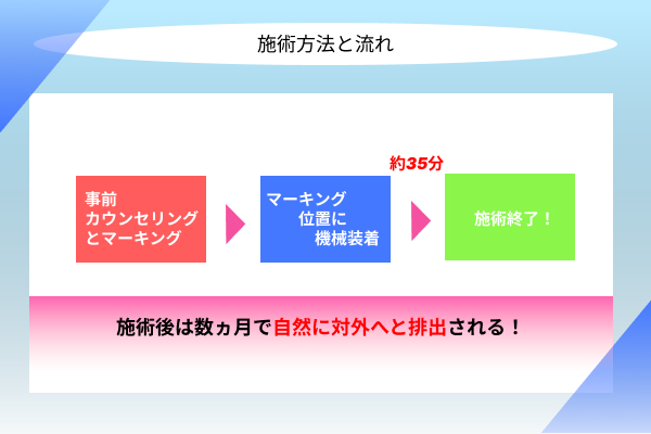 施術の流れについての画像